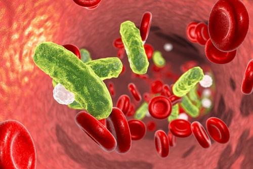 Chicago Birth Injury Lawyers for Sepsis